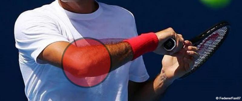 Feeling Elbow Pain During Tennis Matches. Nike Has The Solution