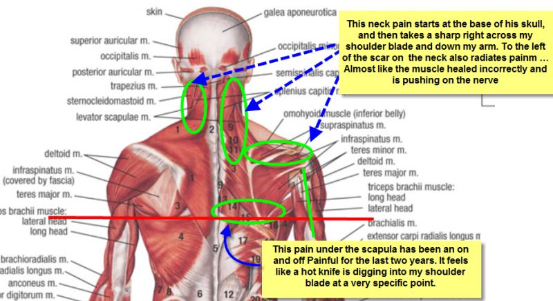 Feeling Sore Muscles After Workouts. How The Theragun Elite Relieves Muscle Tension And Pain