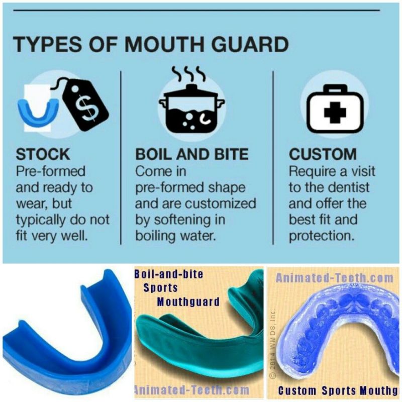 Find the Best Sisu Mouthguard Near You with This Easy Guide