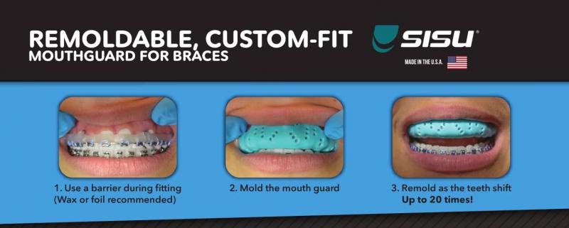 Find the Perfect Mouthguard for Sports: Learn All About the Clear Sisu Slim