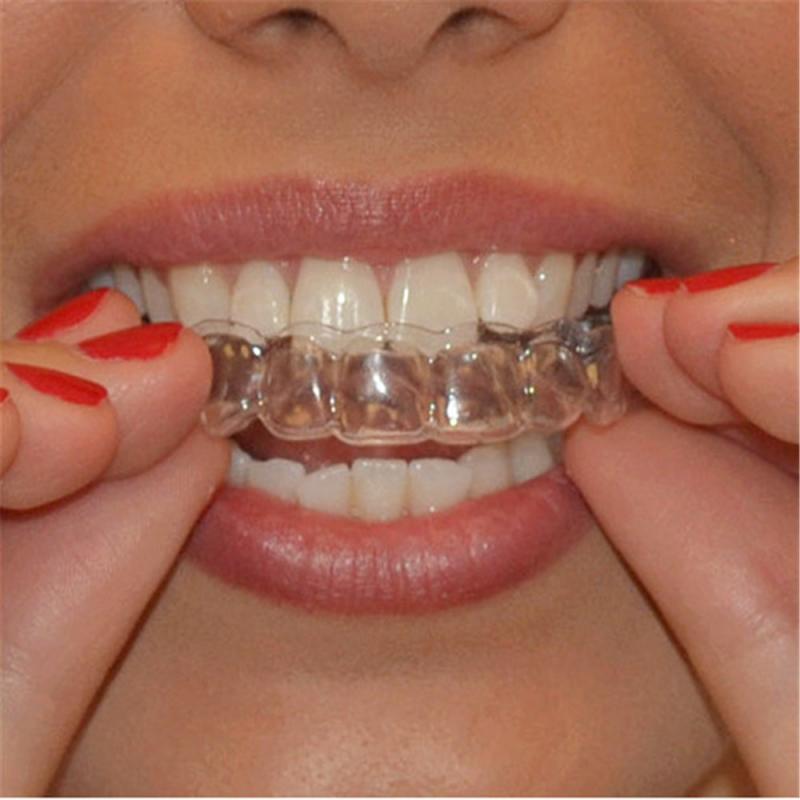 Finding the Best Mouthguard for Braces in 2023: A Complete Buyer