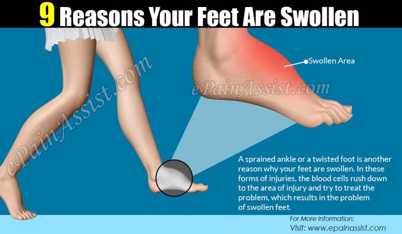 Give Your Feet A Fighting Chance On Icy Surfaces This Winter: Why Slip-Resistant Footwear Is Essential