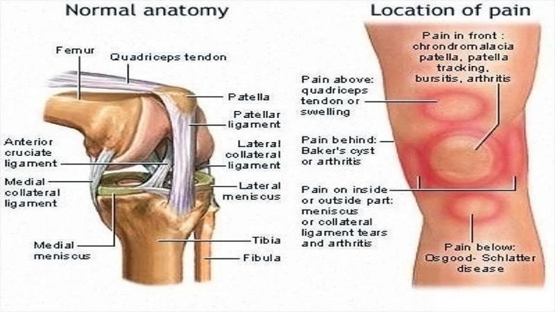 How Can Shock Doctor Knee Braces Relieve Your Joint Pain