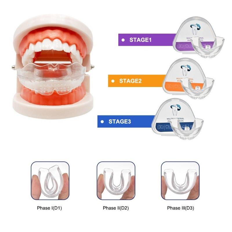 How to Choose the Best Mouthguard for Braces This Year