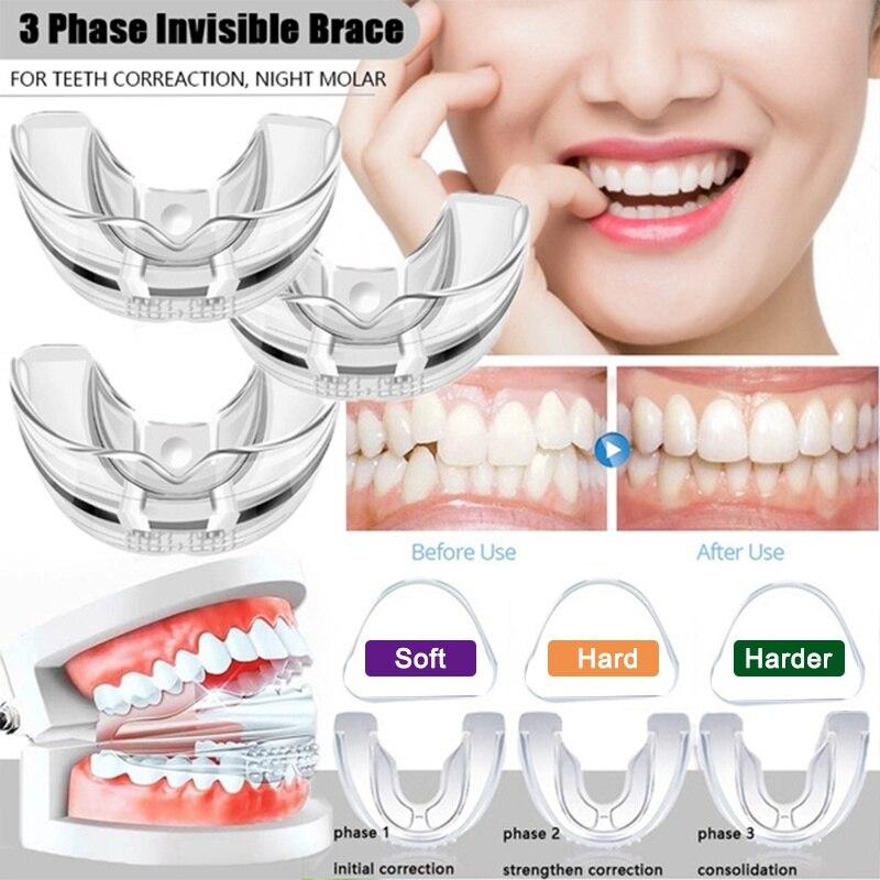 How to Choose the Best Mouthguard for Braces This Year