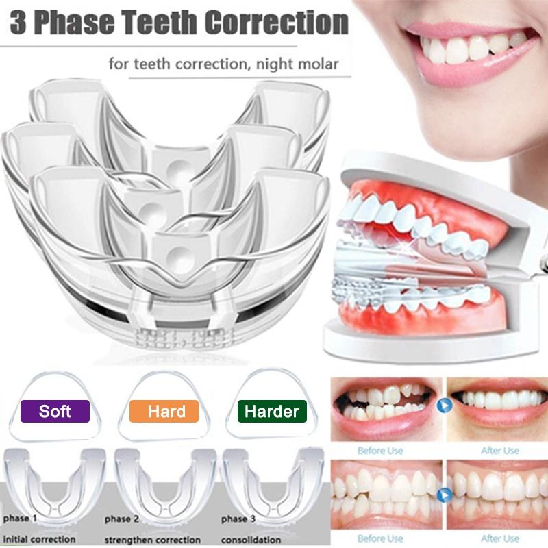 How to Choose the Best Mouthguard for Braces This Year