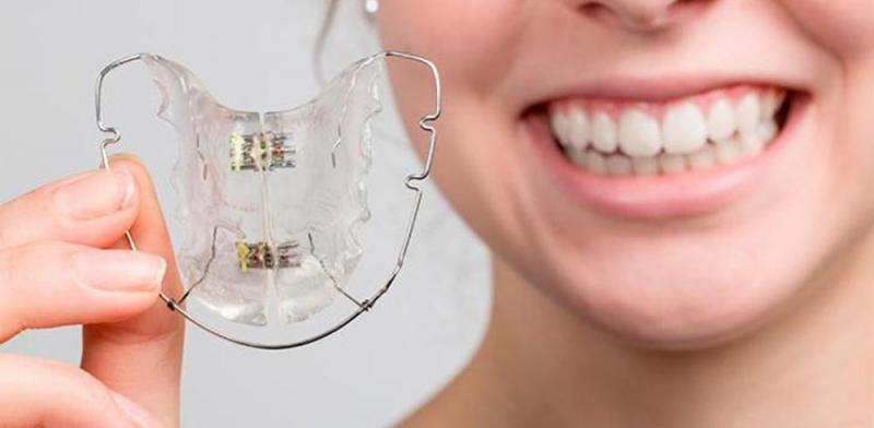 How to Choose the Best Mouthguard for Braces This Year