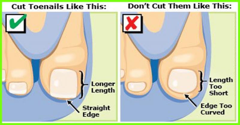 How to Choose the Best Podiatrist in Seattle. Here