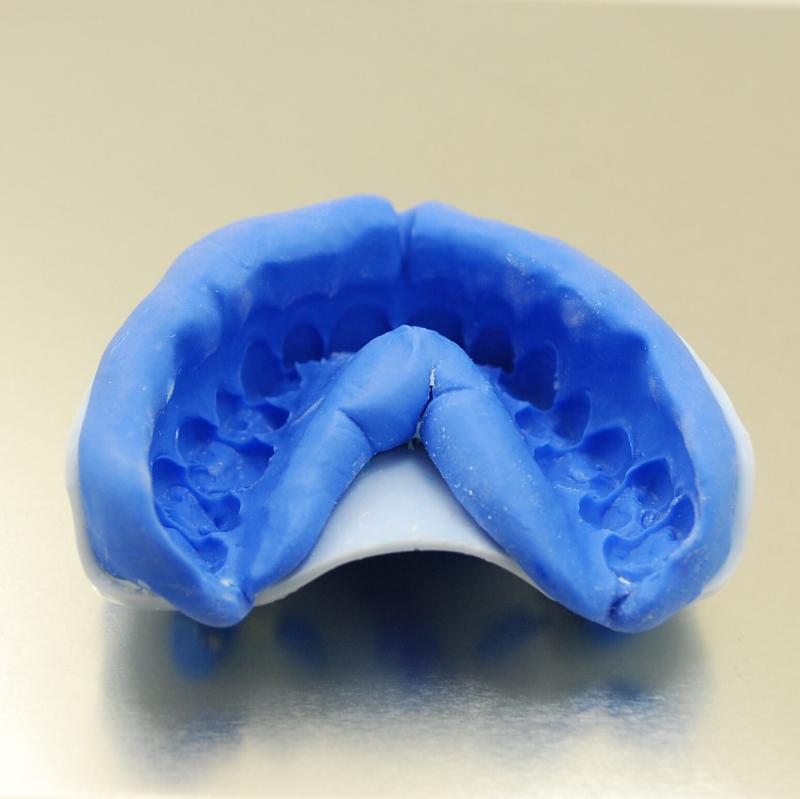 How to Fit Your Custom Mouthguard Like a Pro in 5 Steps