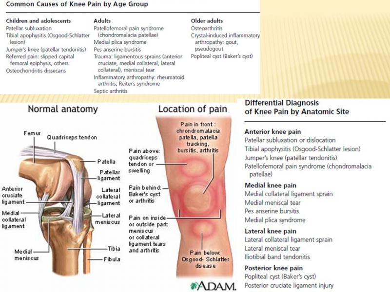 Is That Knee Pain Slowing You Down From Training. Try This Advanced Patella Support Trick Today