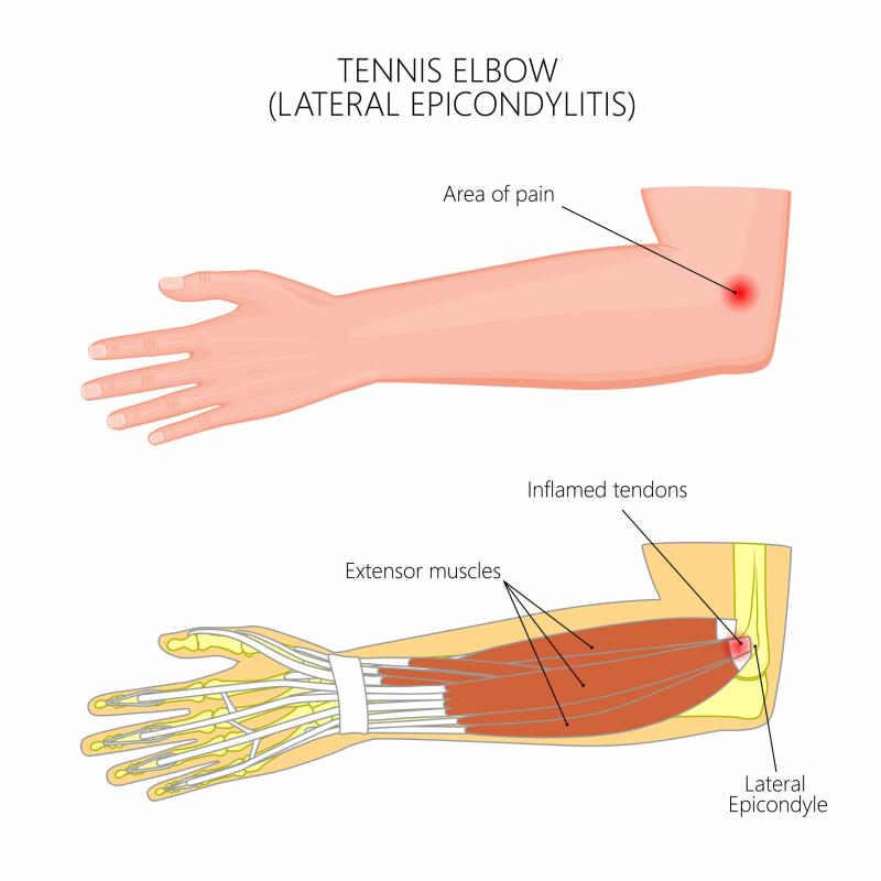 Is Your Lacrosse Arm Protection Up to Snuff. The Top 15 Forearm and Elbow Pads to Dominate in 2023