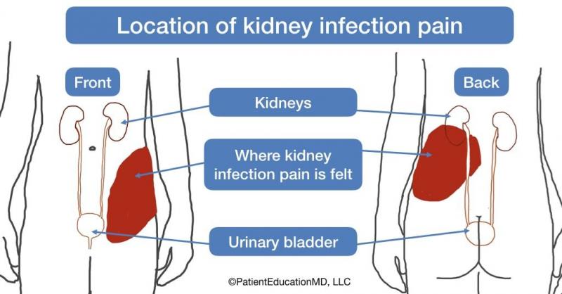 Kidney Pads Lacrosse: Are You Properly Protecting Your Ribs & Organs During Play