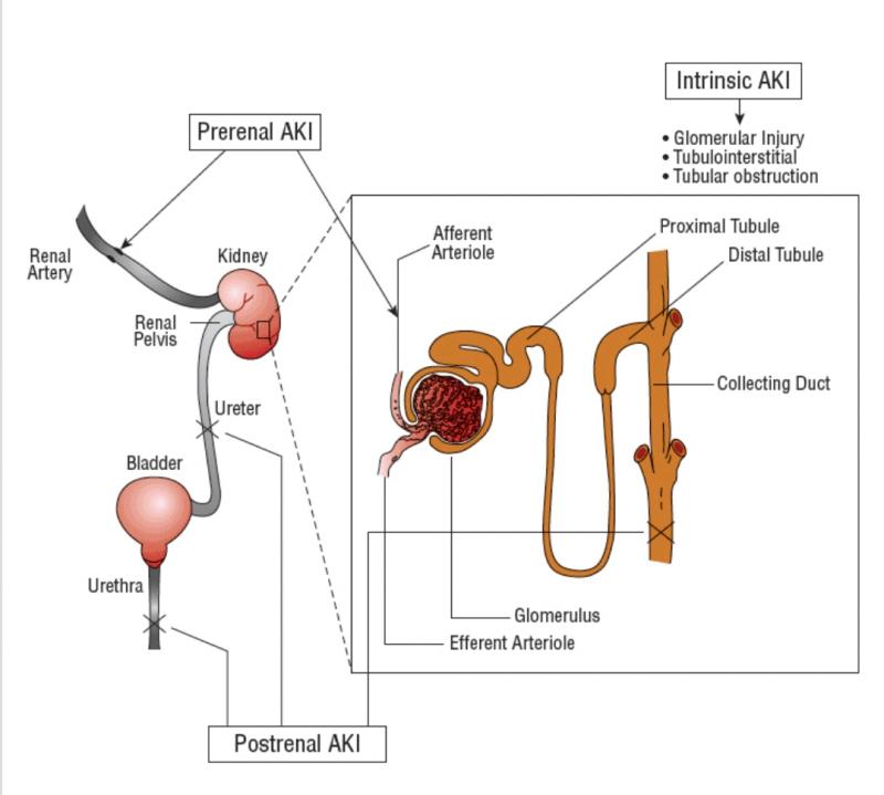Kidney Pads Lacrosse: Are You Properly Protecting Your Ribs & Organs During Play