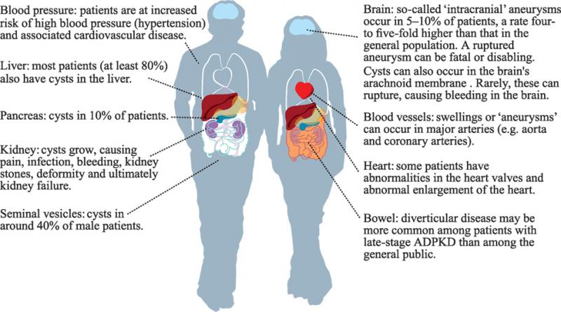 Kidney Pads Lacrosse: Are You Properly Protecting Your Ribs & Organs During Play