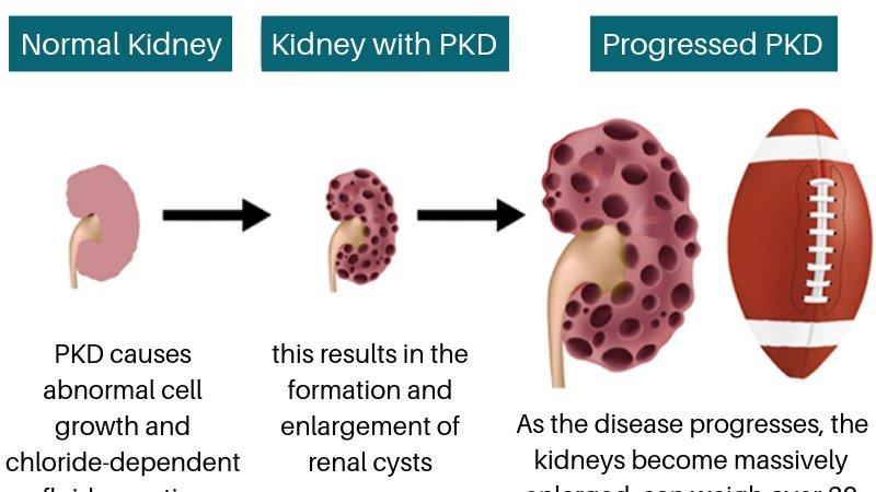 Kidney Pads Lacrosse: Are You Properly Protecting Your Ribs & Organs During Play