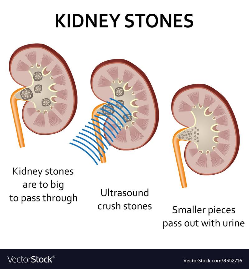 Kidney Pads Lacrosse: Are You Properly Protecting Your Ribs & Organs During Play