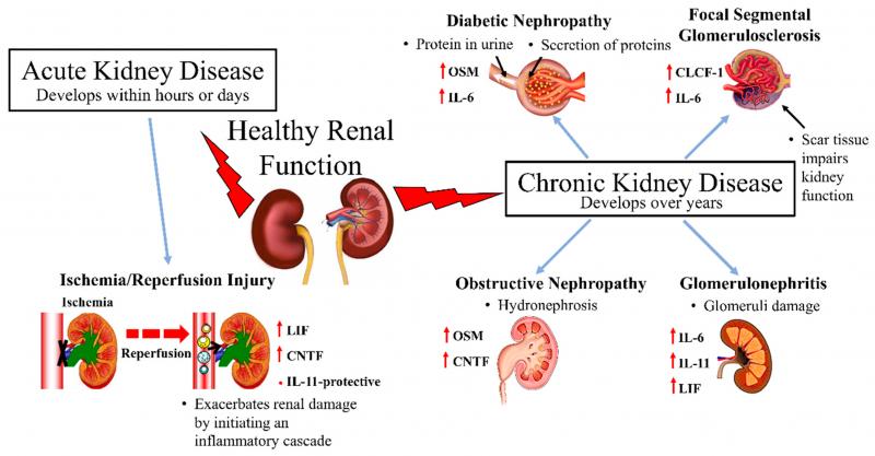 Kidney Protector Lacrosse: Are You Missing This Key Gear for Exhilarating Gameplay