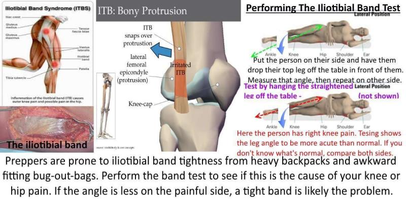 Knee Pain Got You Down. Find Out How Mueller Knee Supports Can Help