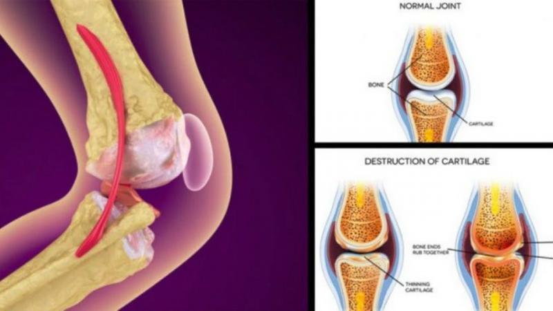 Knee Pain Got You Down. Find Out How Mueller Knee Supports Can Help