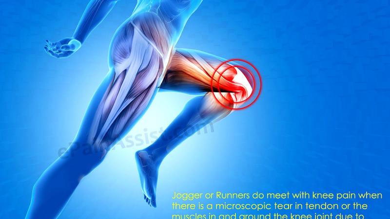 Knee Pain Got You Down: Read Our Shock Doctor Knee Sleeve Review