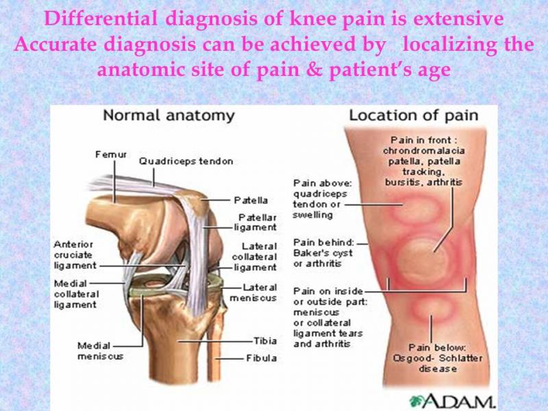 Knee Pain Got You Down. This Doctor