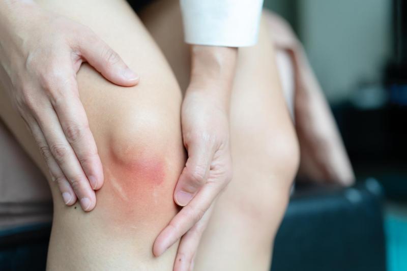 Knee Pain Got You Down. This Doctor