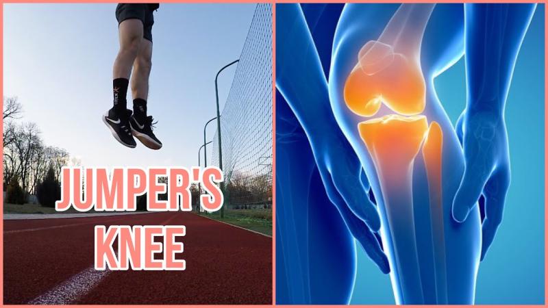 Knee Pain Got You Down. Uncover The Best Nike Volleyball Knee Pads