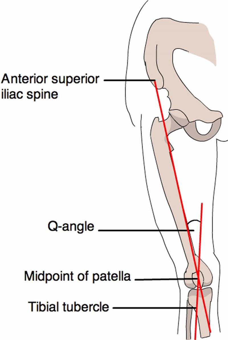 Knee Pain in Young Athletes: How the Right Patellar Support Can Prevent Injuries