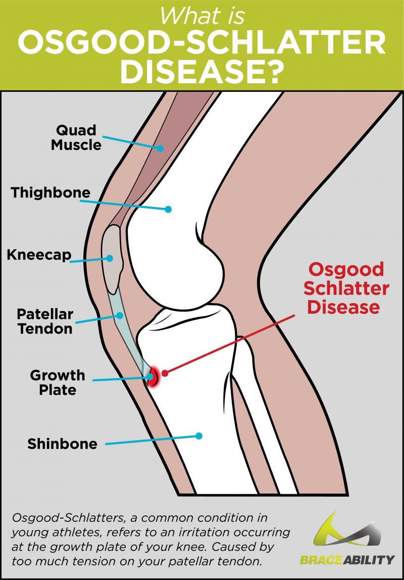 Knee Pain in Young Athletes: How the Right Patellar Support Can Prevent Injuries