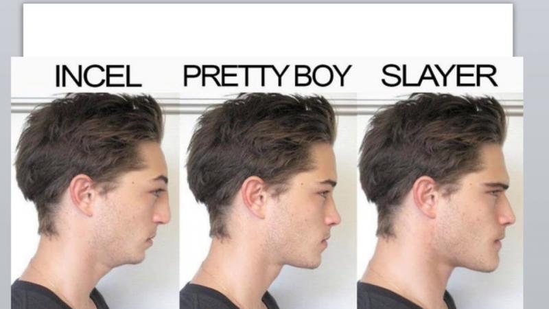 Lacrosse Chin Straps Too Tight. 14 Tips To Add Comfort & Avoid Pain