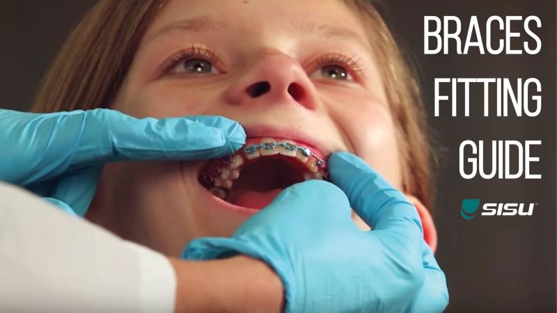 Lacrosse Players: Is a SISU Nextgen Aero Guard the Best Mouthguard. The Answer May Surprise You