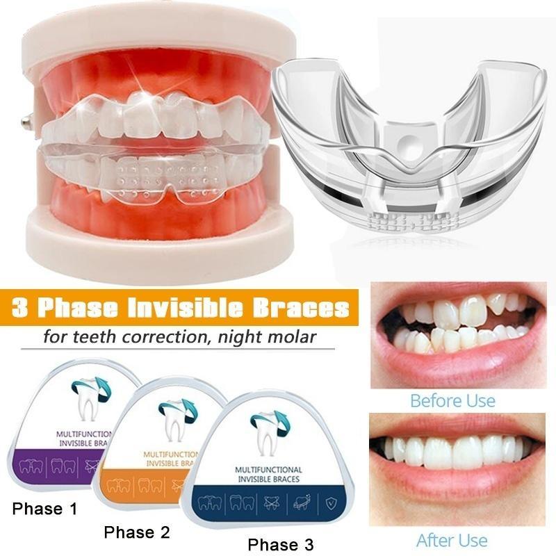 Looking for a Comfortable Mouthguard for Double Braces. Discover the Top 15 Tips and Products in 2023