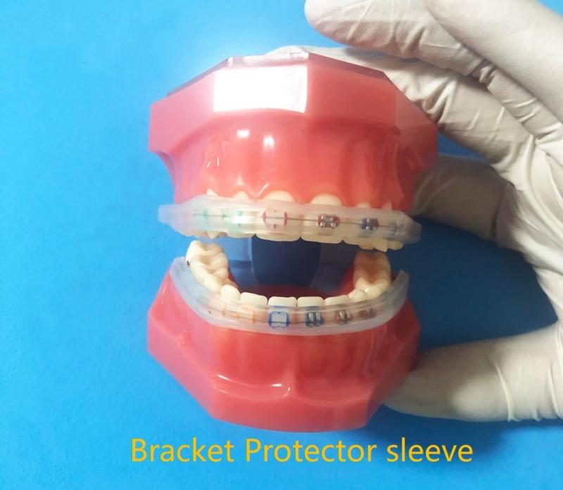 Looking for a Comfortable Mouthguard for Double Braces. Discover the Top 15 Tips and Products in 2023