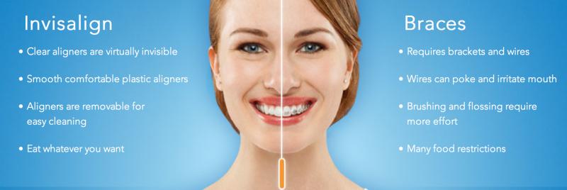 Looking for Orthodontic Care in Lakewood Ranch or Sarasota. 15 Must-Know Tips for Finding the Best Orthodontist