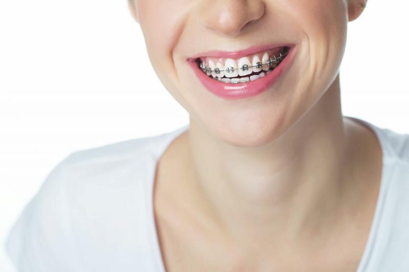 Looking for Orthodontic Care in Lakewood Ranch or Sarasota. 15 Must-Know Tips for Finding the Best Orthodontist