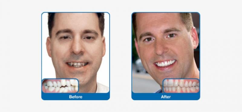 Looking for Orthodontic Care in Lakewood Ranch or Sarasota. 15 Must-Know Tips for Finding the Best Orthodontist