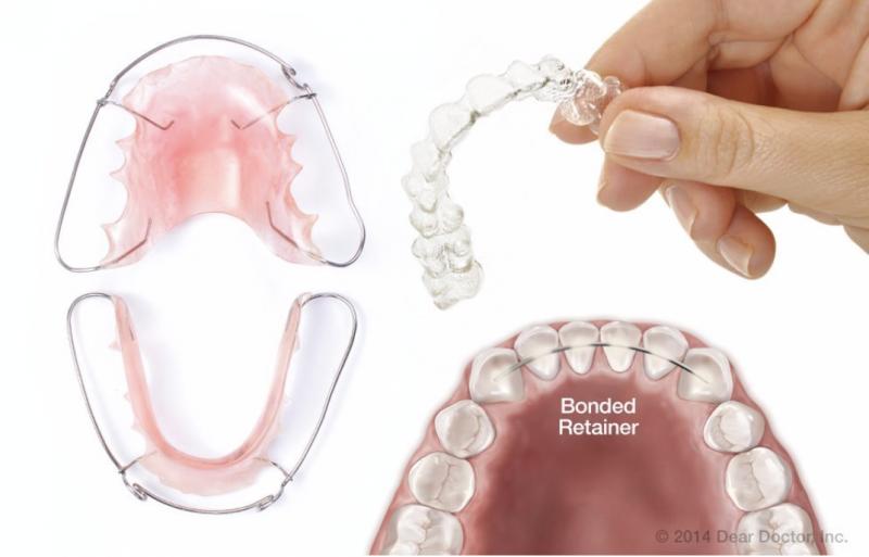 Looking for Orthodontic Care in Lakewood Ranch or Sarasota. 15 Must-Know Tips for Finding the Best Orthodontist