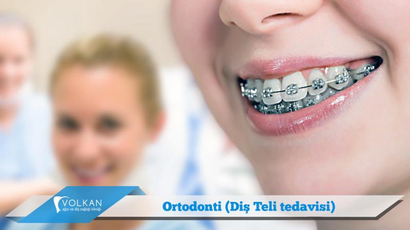 Looking for Orthodontic Care in Lakewood Ranch or Sarasota. 15 Must-Know Tips for Finding the Best Orthodontist