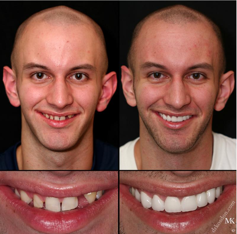 Looking for Orthodontic Care in Lakewood Ranch or Sarasota. 15 Must-Know Tips for Finding the Best Orthodontist