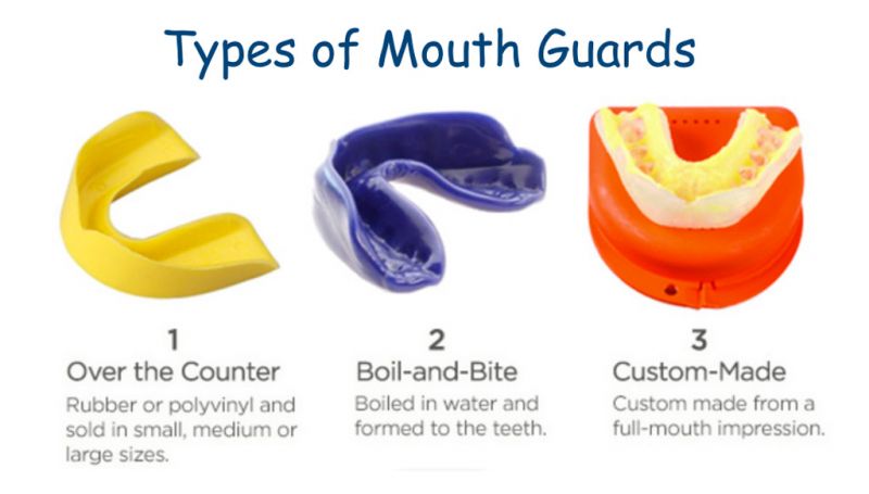 Master Your Look and Protect Your Game with a Fang Mouthguard