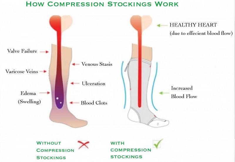 Need Better Leg Circulation. Try These Compression Leggings