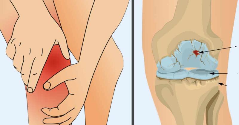 Soothe Foot Pain Fast With These Simple Solutions