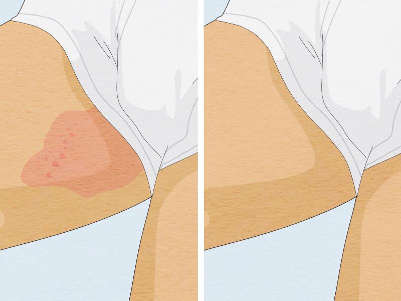 Stop Chafing With These 15 Anti-Chafe Shorts: The Ultimate Guide