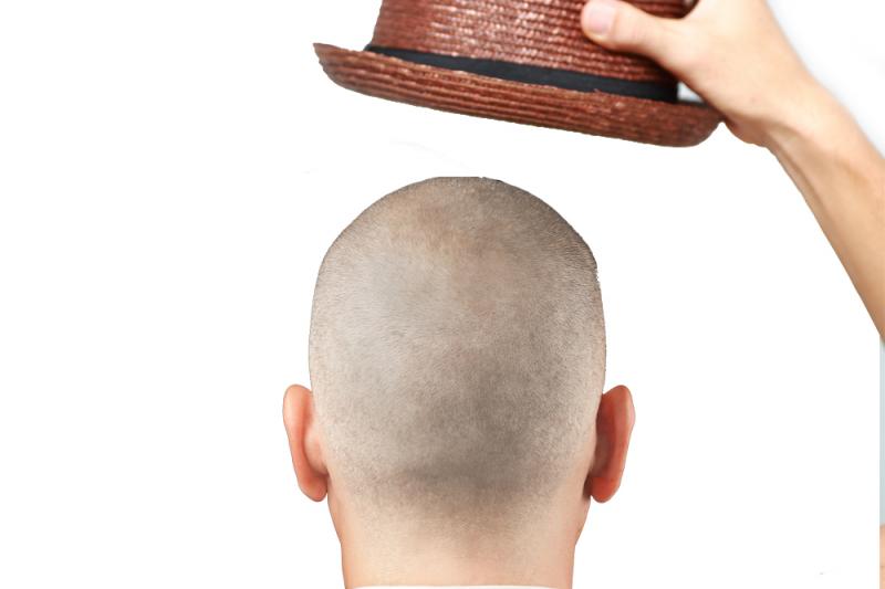 Sun Hats for Balding Men: The 14 Best Options to Protect Your Scalp This Summer