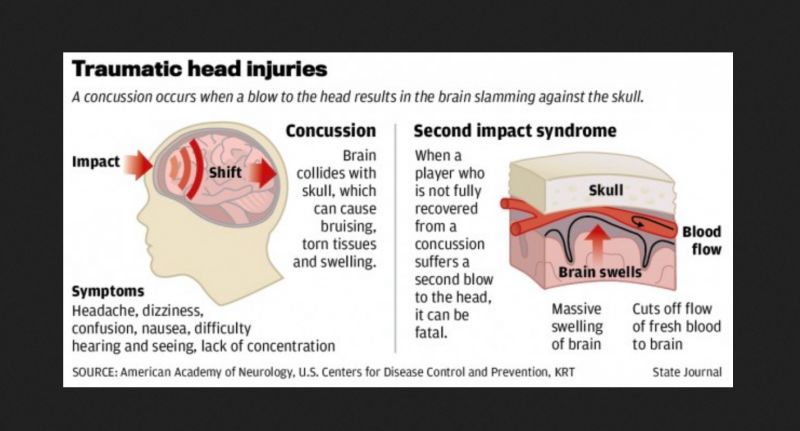 The Q Collar for Concussion Prevention and Recovery