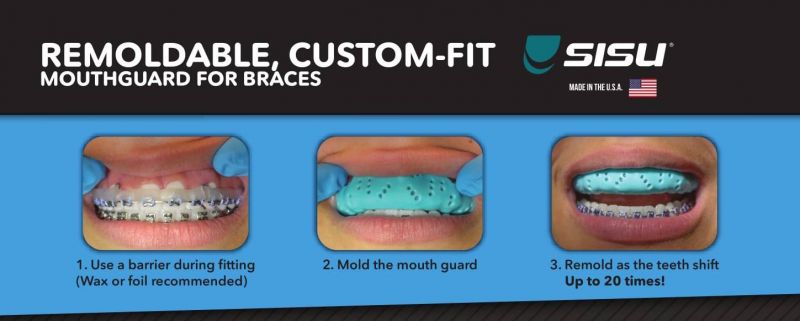 The Ultimate Guide to Buying and Using Sisu Mouthguards for Sports