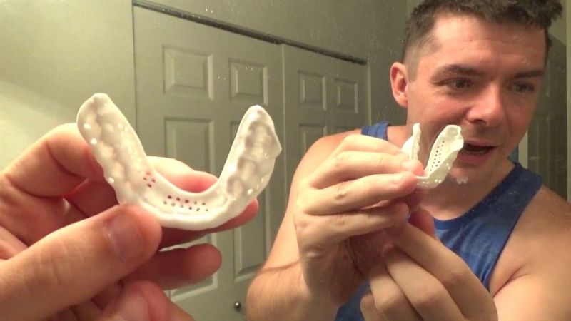 The Ultimate Guide to Buying and Using Sisu Mouthguards for Sports