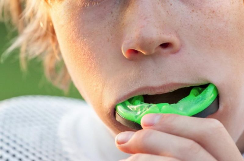 Transform Your Game with a Custom 3D Printed Mouthguard