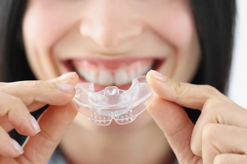 Want a Flavored Mouthguard That Also Shields Braces: Discover the Best Women