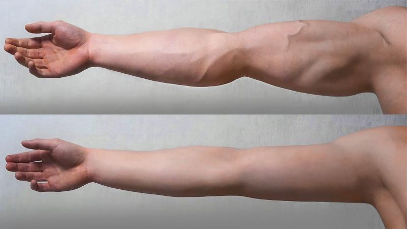 Want Bigger Arms Fast. : Bicep Pads Transform Skinny Arms in Weeks